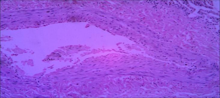 Figure 9: Section of specimen (3) lung tissue.