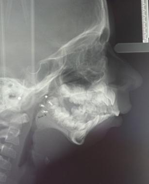 Figure 2: Front and perfil view.