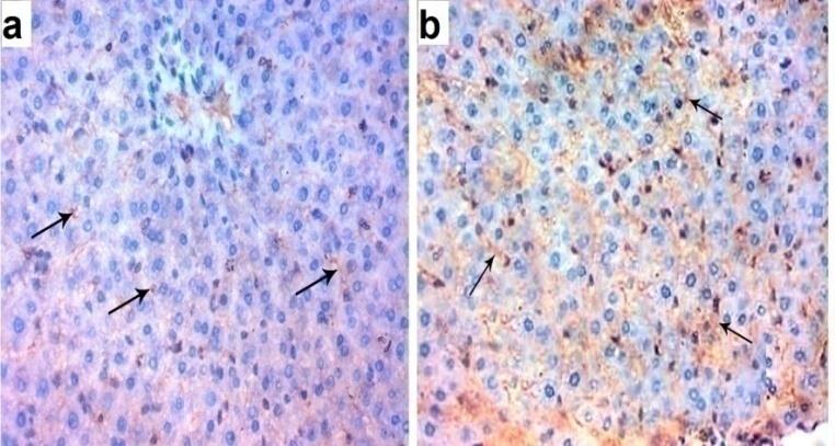 Figure 10: A photomicrograph of a liver section of ACR plus VE treated groups: (a,b) D1ACRVE showing few amount of blue colored collagen fibers (bifid tailed arrow) around the central vein (CV), in the lining of blood sinusoid (arrow) and in the portal area (P) (bifid tailed arrow). (c) D21ACRVE showing few amount of blue colored collagen fibers (bifid tailed arrow) around the central vein (CV) and in the lining of blood sinusoid (arrow). (d) D21ACRVE showing moderate amount of blue colored collagen fibers (bifid tailed arrow) in the portal area (P) and in the lining of blood sinusoid (arrow). (Mallory stain X400). **Immunohistochemical** **Staining:** Liver section of D1ACRVE subgroup revealed mild positive cytoplasmic immune reaction to caspase 3**.**InD21ACRVE subgroup showed moderate positive cytoplasmic immune reaction to caspase 3 (Figure 11).