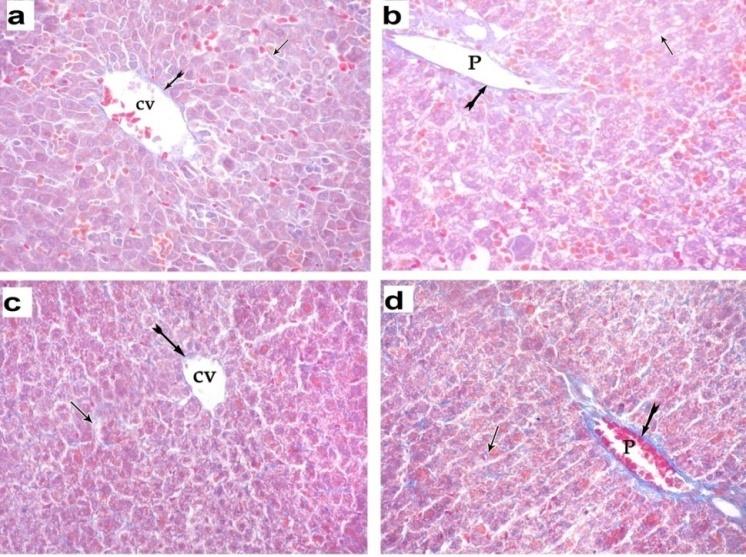 Figure 11: A photomicrograph of a liver section of ACR plus VE treated groups: (a) D1ACRVE and (b) D21ACRVE showing mild expression of cytoplasmic immune reaction for caspase 3 (arrow). (Immunoperoxidase technique for caspase 3 X 400). EM Examination: EM study of liver sections of D1ACRVE showed nearly typical ultra structure of the liver. The hepatocytes appeared with euchromatic nuclei and intact nuclear envelope. The cytoplasm contained numerous mitochondria, rough endoplasmic reticulum, some lipid droplets and glycogen granules. Liver sections of D21ACRVE showed improvement of hepatic ultra structure when compared to D21ACR to subgroup. Some hepatocytes appeared with euchromatic nuclei and intact nuclear envelope while some others had abnormally indented nucleus with in continuous nuclear envelope and peripherally condensed chromatin. The cytoplasm contained numerous mitochondria, rough endoplasmic reticulum, some lipid droplets, glycogen granules and some vacuoles. The hepatocytes were adjacent to each other with bile canaliculi containing (Figure 12).
