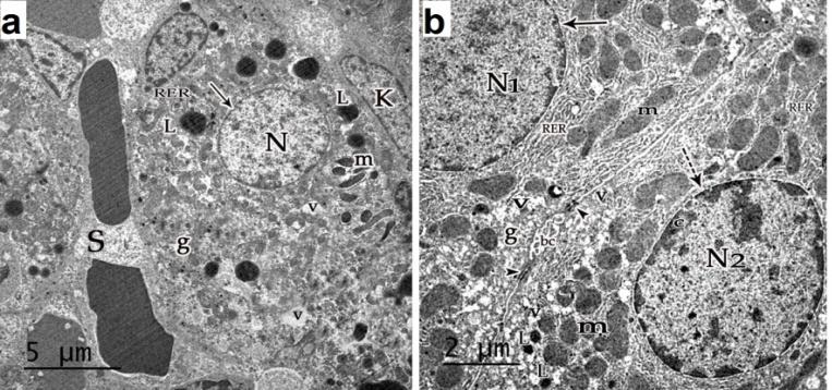 Figure 12: An EM micrograph of a section in the liver of ACR plus VE treated groups: (a) D1ACRVE showing normal hepatocyte with euchromatic nucleus (n) and intact nuclear envelope (arrow). The cytoplasm contains some abnormal mitochondria (m), few rough endoplasmic reticulum (RER), many lipid droplets (L), some vacuoles (v) and glycogen granules (g). Notice the nearby blood sinusoid (S) and Kupffer cell (k). (X 6800); (b) D21ACRVE showing upper normal hepatocyte with euchromatic nucleus (N1) and intact nuclear envelope (arrow). The lower hepatocyte had slightly indented nucleus (N2) with in continuous nuclear envelope (cut arrow) and peripherally condensed chromatin (c). The cytoplasm contained some abnormal mitochondria (m), rough endoplasmic reticulum (RER), many lipid droplets (L), some vacuoles (v) and glycogen granules (g). Notice normal bile canaliculus (bc) containing microvilli and occluding junction around it (head arrow). (X 13600).