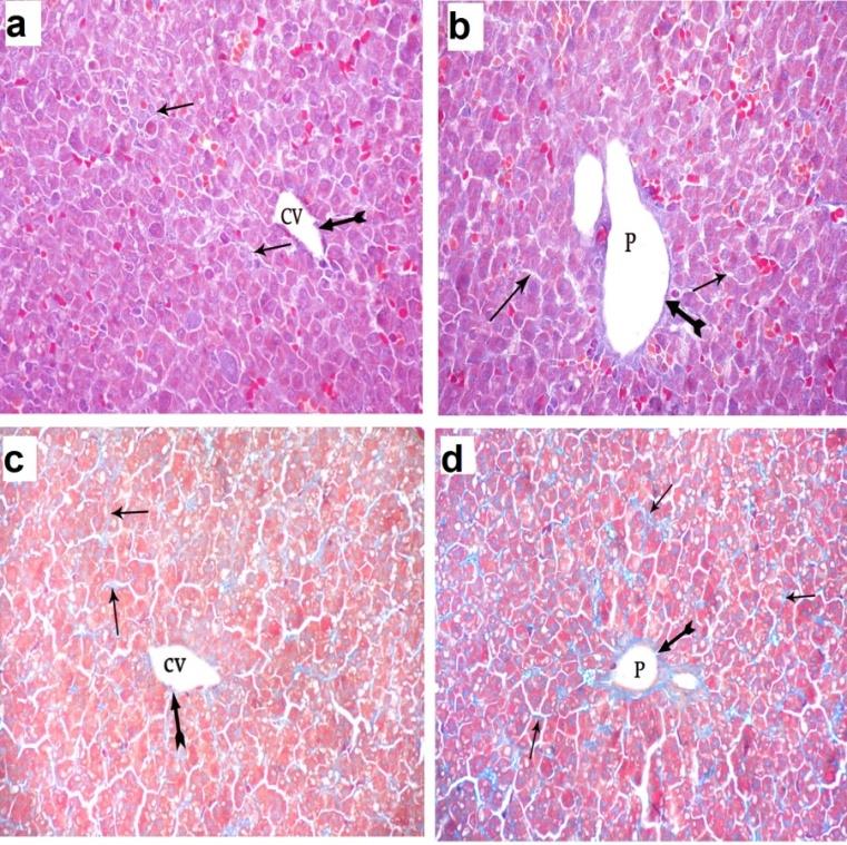 Figure 3: A photomicrograph of a liver section of control groups: (a) D1 and (b) D21 showing negative cytoplasmic immune reaction for caspase 3 (arrow). (Immuno peroxidase technique for caspase 3 X 400). EM Examination: EM study of D1control subgroup showed that the hepatocytes appeared with euchromatic nuclei and intact nuclear envelope. The cytoplasm contained numerous mitochondria, rough endoplasmic reticulum, some lipid droplets and glycogen granules. The hepatocytes were adjacent to each other with bile canaliculi containing microvilli and occluding junctions were observed. Also normal appearance of hepatocytes was detected in D21 (Figure 4).