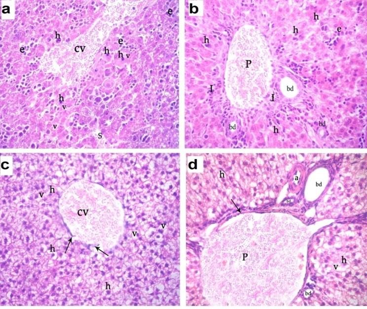Figure 6: A photomicrograph of a liver section of ACR- treated groups: (a) D1ACR showing mild increased blue colored collagen fibers (bifid tailed arrow) around the central vein (CV) and also in the lining of blood sinusoid (arrow). (b) D1ACR showing increased amount of blue colored collagen fibers (arrow) in the portal area. (c,d) D21ACR showing increased amount of blue colored collagen fibers (bifid tailed arrow) around the central vein (CV), in in the portal area (P) (bifid tailed arrow) and also in the lining of blood sinusoid (arrow). (Mallory stain X400). Immunohistochemical Staining: Liver from D1ACRsubgroup showed many positive reactions for activated caspase3 in cytoplasm of hepatocytes. Liver of D21ACR subgroup showed extensive positive reaction for activated caspase3 more than D1 in the cytoplasm of hepatocytes (Figure 7).