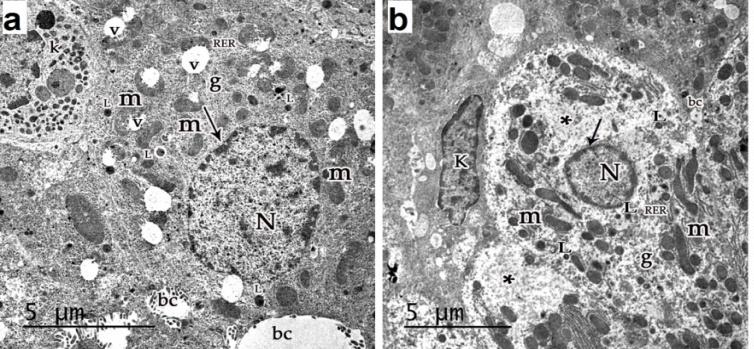 Figure 9: A photomicrograph of a liver section of ACR plus VE treated groups: (a) D1ACRVE showing normal or slightly dilated central vein (cv), multiple small sized blood sinusoids (s), normal hepatocytes (h) with polygonal large vesicular nuclei and acidophilic cytoplasm. Few vacuoles (v) are present in the cytoplasm of some hepatocytes. Multiple erythroid islands (e) with intense hyperchromatic nuclei are noticed. (b) D1ACRVE showing normal or slightly dilated portal vein(p), normal bile duct (bd), multiple small sized blood sinusoids (s), normal hepatocytes (h). Some hepatocytes had dark stained nuclei (arrow) and others had pale nuclei (curved arrow). Few vacuoles (v) in the cytoplasm can be seen. Multiple erythroid islands (e). (c) D21ACRVE showing normal or slightly dilated central vein (cv), multiple small sized blood sinusoids(s), normal hepatocytes (h). Few vacuoles (v) are present in the cytoplasm of some hepatocytes. Some hepatocytes had dark stained nuclei (arrow). Kupffer cells (curved arrow) are seen in the lining of blood sinusoids. (d) D21ACRVE showing normal portal vein (p) and bile duct, multiple small sized blood sinusoids (s), normal hepatocytes (h). Some hepatocytes had dark stained nuclei (arrow) and others had pale nuclei (curved arrow).Few vacuoles (v) in the cytoplasm can be seen. (H&E X400). **Mallory staining:** Mallory stained sections of D1ACRVE subgroup showed few amount of collagen fibers around the central veins, blood sinusoids and portal area**.** Liver sections of D21ACRVEsubgroup showed also few amount of collagen fibers around the central veins, blood sinusoids and portal area (Figure 10).