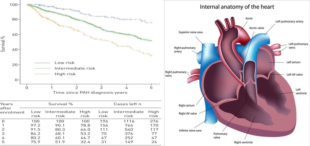 Figure 1: The comparison of three varying risk groups of patients with pulmonary hypertension. Interpretation leads to an understanding that in all three groups, an increase in disease diagnosis relates to a prolonged survival rate of pulmonary hypertension patients. Graphical comparison links to the image as a visual understanding of the manner in which pulmonary hypertension occurs. Heart anatomy has been edited to show this. Original data source: Marius, et al. [10].