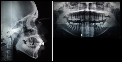 Figure 2: Pre-treatment Extraoral radiographs.