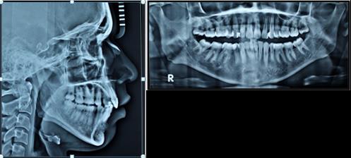 Figure 5: Post treatment extraoral radiographs.