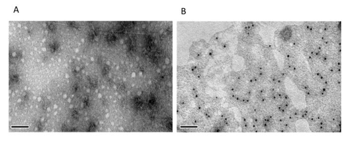 Figure 3: TEM images of VLPs assembled from Cap proteins. VLPs purified from gE-tk-/PCV2cap+ PRV- infected cell lysates were negatively stained (A) and treated MAb to PCV2 Cap for immunogold staining (B), and observed by TEM. The scale bar is 100nm.