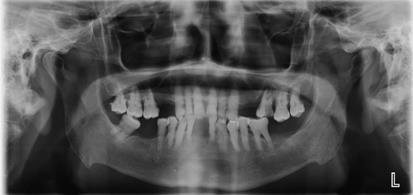 Figure 1: No extra oral abnormalities were recorded.