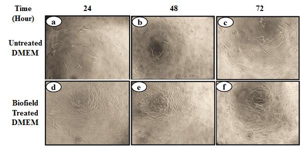 Figure 1: The results suggested that the number of cells were increased at 48 and 72 hours as compared with 24 hours interval in the presence of untreated DMEM (Figure 1a-1d). Similar pattern of growth was observed in the Biofield Energy Treated DMEM, which suggest a significant increased number of cells at 48 hours (Figure 1e) and 72 hours (Figure 1f). This suggests that Mr. Trivedi’s Biofield Energy Treatment has the significant capacity to improve the cellular proliferation and cell growth, which might be useful as a skin health or would work as antiaging therapy [27].