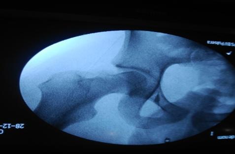 Figure 3: TDM 3D.