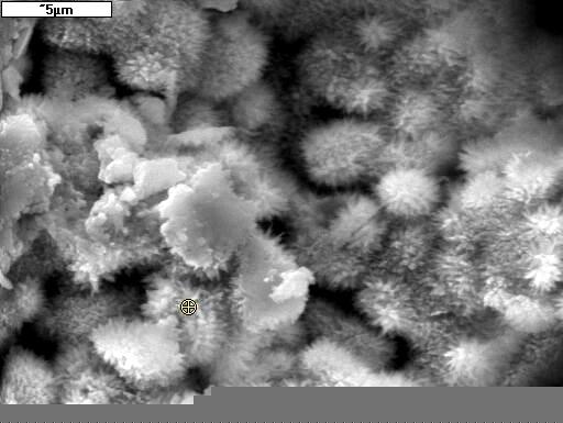 Figure 12: Oxalate crystals crystallized on “non- working” part of the socket of hip joint endoprosthesis. SEM.