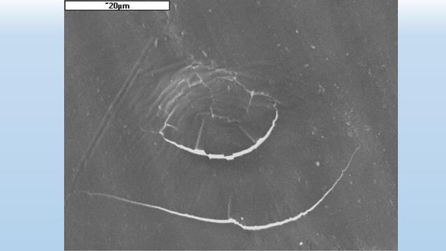 Figure 7: Microscopic image of the cross-section of a new acetabulum. The surface layer (arrows) shows no differences from the deeper parts of the acetabulum. Polarizing microscope, polaroids X, magnification 180 x.