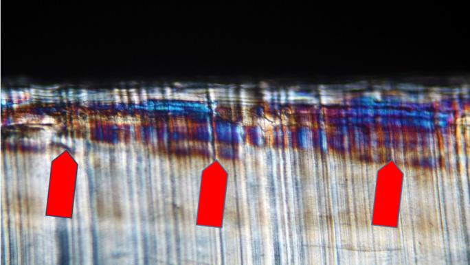 Figure 8: Microscopic image of the cross-section of a worn-out acetabulum. The surface layer (arrows) shows differences from the deeper parts of the acetabulum. It shows as changes in the interference colors of polarized light. Polarizing microscope, polaroids X, magnification 180 x.