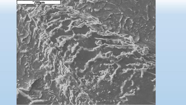 Figure 9: “Oscillating” marks of socket surface damage as a result of movement of the damaging fragment. SEM.