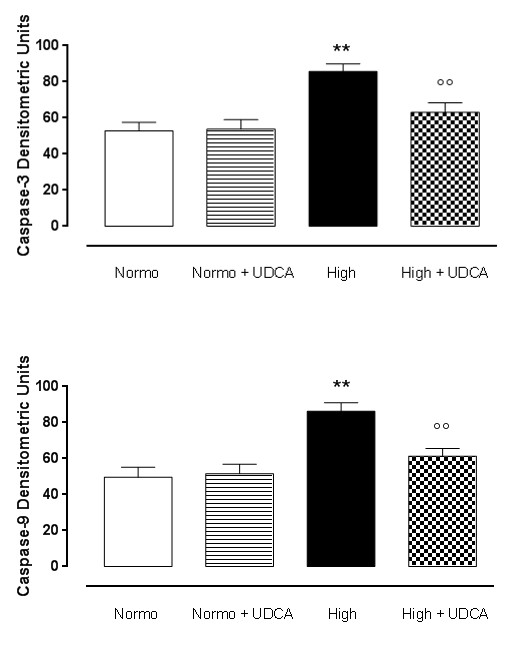 Figure 3: UDCA and ubiquitin proteasome system (UPS) expression. Depicted are the graphs concerning the levels, in densitometric units, of ubiquitin (panel A), 20S protesome (panel B), 19S proteasome (panel C), and 26S proteasome (panel D) subunits in rat hearts perfused with 11.1 mmol D-glucose (Normo), 33.3 mmol D-glucose (High) and pre- treated or not with ursodeoxycholic acid (UDCA, 150 mg/kg) in drinking water for 6 weeks. (E) Representative perfused with high glucose Krebs (Figure 3A-3E). UDCA pretreatment (150 mg/kg) resulted in a significant (p <0.1) decrease of the expression levels of all the UPS subunits Ubiquitin, 19S proteasome, 20S proteasome and 26S proteasome (Figure 3A-3E). The hearts collected from rats treated with UDCA alone and perfused with normal glucose show normal expression of UPS subunits if compared to the expression levels observed in the heart without treatment and perfused with normal Krebs (Figure 3A-3E).