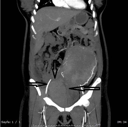 Figure 1: Computed Tomography.