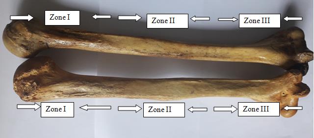 Figure 1: Showing zones in humerus bone.
