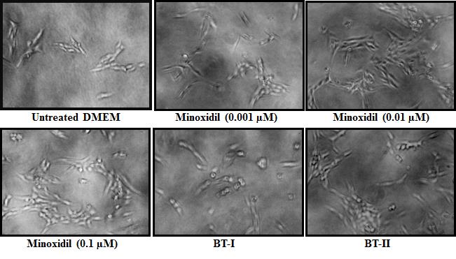 Figure 2: Effect of Biofield Energy Treated DMEM on the proliferation of dermal papilla cells (DPCs) in human follicular dermal papilla cell line (HFDPC) and the representative images of different treatment groups. BT-I: One-time Biofield Energy Treated DMEM; BT-II: Two-times Biofield Energy Treated DME.