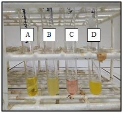 Figure 11: McConkey agar plates. (A) P. vulgaris, non- lactose fermenter (white/colorless growth); (B). E. coli, lactose-fermenter (pinkish growth); (C) Isolate A4, non-lactose fermenter.