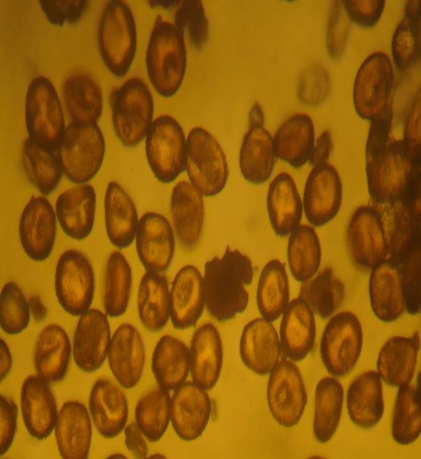 Figure 2: Germinated urediniospores of tef leaf rust.