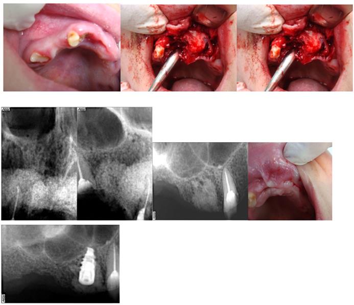 Figure 11