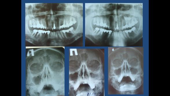 Figure 12