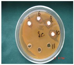 Figure 4: Osteointegration plates in a bone with bioceramics сovering and without.