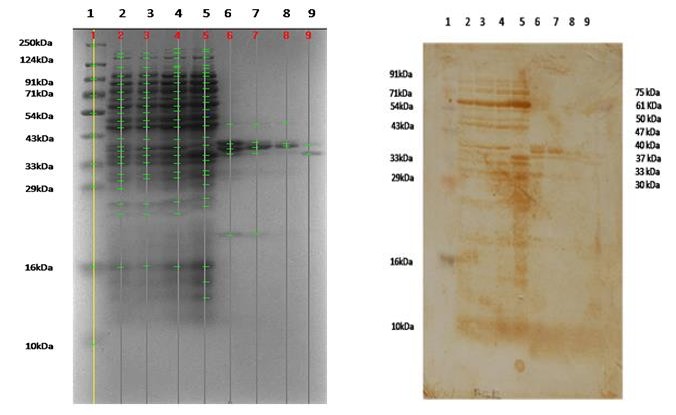Figure 1: Effect of 61 kDa and 37 kDa _E. tarda_ proteins as immunogen on white blood cell count in rohu blood.