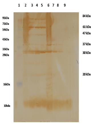 Figure 2: Effect of 61 kDa and 37 kDa _E. tarda_ proteins as immunogen on NBT activity in rohu blood.