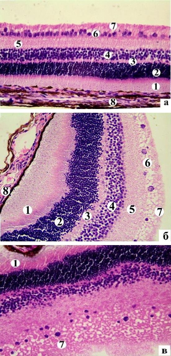 Figure 2: The hystostructure of the rabbit’s retina (а) and retinal edema at the 30th day optic nerve crush (б, в) Half- thin section. Stained with hematoxylin and eosin. Magn. х400. Notes: 1 – PSL, 2 – ONL, 3 – ORL, 4 – INL, 5 – IRL, 6 – GCL, 7 – NFL, 8 – pigment layer.