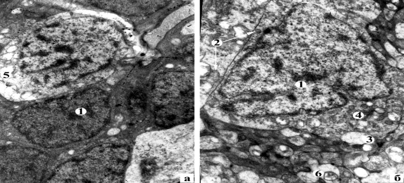 Figure 3: Histostructure of the NS of the hypothalamus 30 days after treatment Half-thin section, painted with methylene blue.