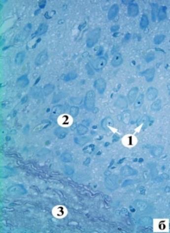 Figure 5: Reactive changes (a) and hydropic dystrophy (b) neurons of the hypothalamus for 30 days Electrographs. Mag.: 8000 Notes: 1 - nucleus of the neuroendocrine cell, 2 - Golgi complex, 3 - GEN, 4 - mitochondria, 5 – vacuoles