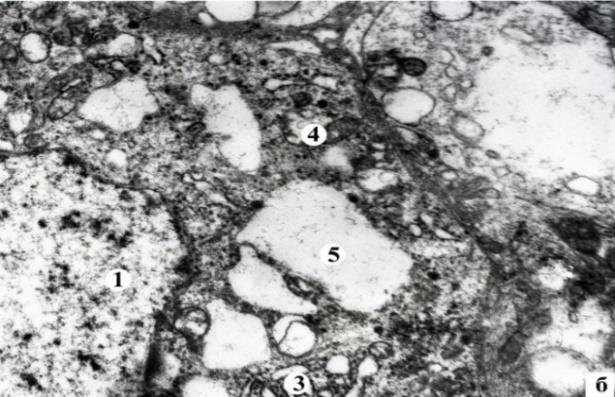 Figure 6: Hystostructure of the III (a) and IV (б) group retina Half-thin section. Stained with hematoxylin and eosin. Magn. х400.