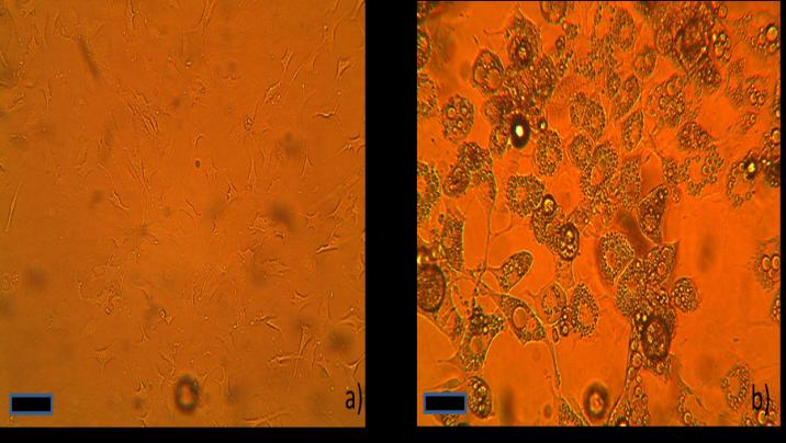 Figure 1: Phase microscope 10X image of 3t3 cells. a) pre-adipocyte form and as b) mature adipocytes after 7 days treatment and incubation in culture media DMEM + 10% fbs with 10 ug/ml insulin. Note the appearance of lipid droplets in the mature adipocyte cells. Scale bar equals 100 μm. Assessment of cell viability with Thiazolyl Blue Tetrazolium Bromide (TBTB/MTT) Cell viability was assessed using 3-4,5-Dimethylthaizol- 2-yl)-2,5-diphenyl tetrazolium bromide assay [17]. Essentially, the cells were incubated with 10mg/ml of TBTB/MTT in the growth media for 4hours. The metabolic activity of cells was measured by the conversion of yellow TBTB/MTT into blue MTT-formazan by the mitochondrial dehydrogenase [18]. The growth media was removed, rinse the adherent cells with phosphate buffered salt solution and develop the colour with 100% DMSO for 12hr and read the absorbance at 570nm.