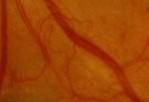 Figure 9: Venous looping.