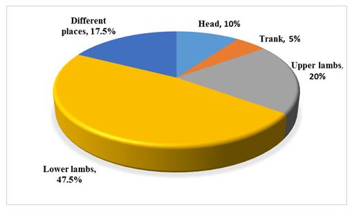 Figure 1: Distribution of work injuries percentages according to the place of injury. This figure reveals that the highest percentages of work injures were in the lower lambs (47.5%) follow by upper lambs injures (20%) and the injures in different places in the body (17.5%).