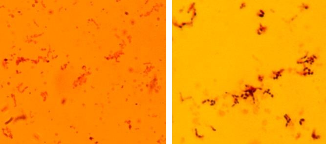 Figure 1: (A) Human isolate, _Kingella kingae_ and (B) Equine isolate _K. equi_.