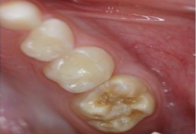Figure 3: Moderate defects.