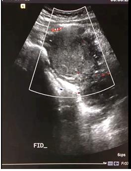 Figure 2: Pelvic Ultrasound.