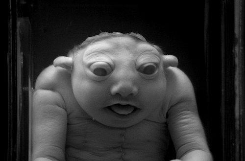 Figure 8: Images of the relevant disorders in the anencephaly syndrome.