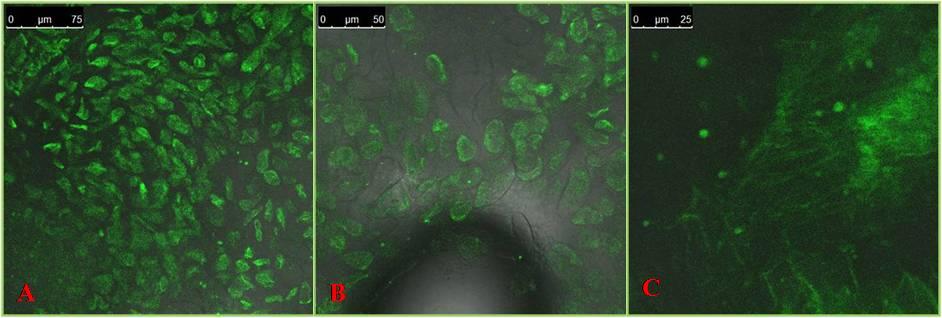 Figure 1: GFP expression in PusaBasmati1, Swarna and Gayatri.