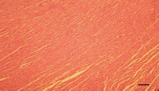 Figure 1: represents control (not treated with monosodium glutamate. There is no change in heart tissues of Wistar rats. Figure 2 showed slightly change in heart myofibers of Wister rat treated with low dose (0.5g). Figure 3 indicated degenerations change on heart tissues of Wister rat treated with medium dose (1.0g). Figure 4 indicated congestions change and hemorrhage on heart tissues of Wister rat treated with high dose (1.5g).