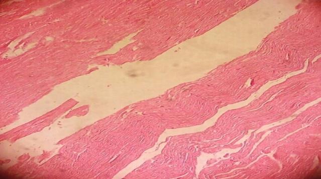 Figure 2: Heart tissues of treated Wistar rats with 0.5 g Monosodium glutamate.