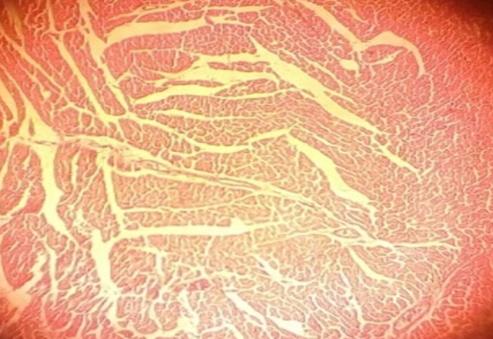 Figure 3: Heart tissues of treated Wistar rats with 1.0 g Monosodium glutamate.