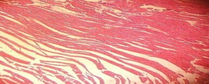 Figure 4: Heart tissues of treated Wistar rats with 1.5 g Monosodium glutamate.