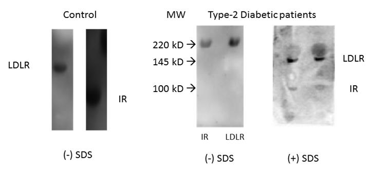 Figure 5: The movement of IR and LDLR band in PBMC of control and type-2 diabetic subjects in presence and absence of SDS.