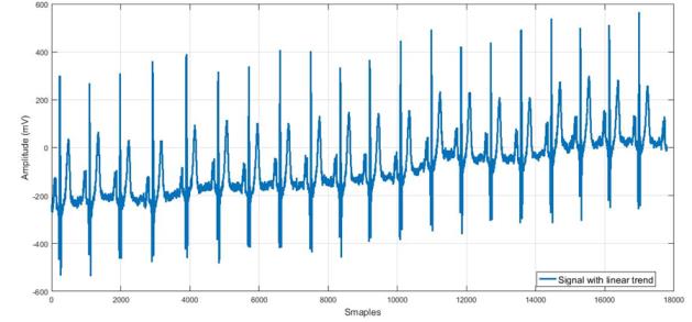 Figure 5: Matching pairs of times series from 19 normal cases. This is an example of alignments for the healthy heart function.
