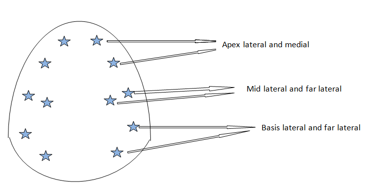 Figure 1: Routine Prostate Biopsy Targeting.