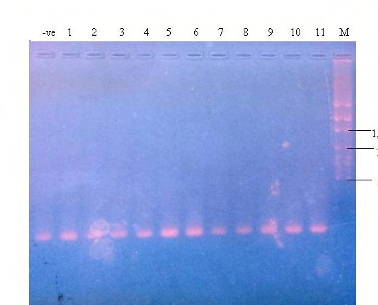 Figure 2: Amplicon of mecA gene: Last lane (right) molecular weight marker; Lane 1-11 mecA negative; First lane (left) internal negative control.